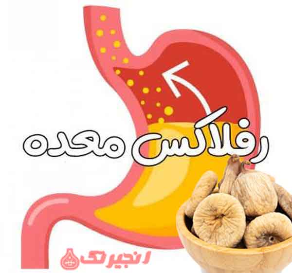 رفلاکس معده یکی از شایع‌ترین بیماری‌ های گوارشی است که به علت به بیرون آمدن اسید معده و محتوای گوارشی به مری و یا جلوی دهانه معده ایجاد می‌شود. برخی از مواد غذایی می‌توانند به عنوان درمان رفلاکس معده مفید باشند و انجیر خشک یکی از آنهاست. انجیر خشک یک میوه خشک شده است که از میوه انجیر به دست می‌آید.  ...